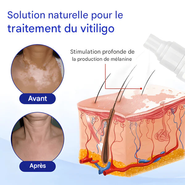 Spray aux Herbes Evenora