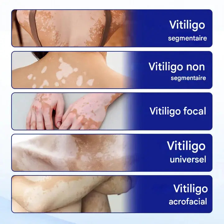 Spray aux Herbes Evenora