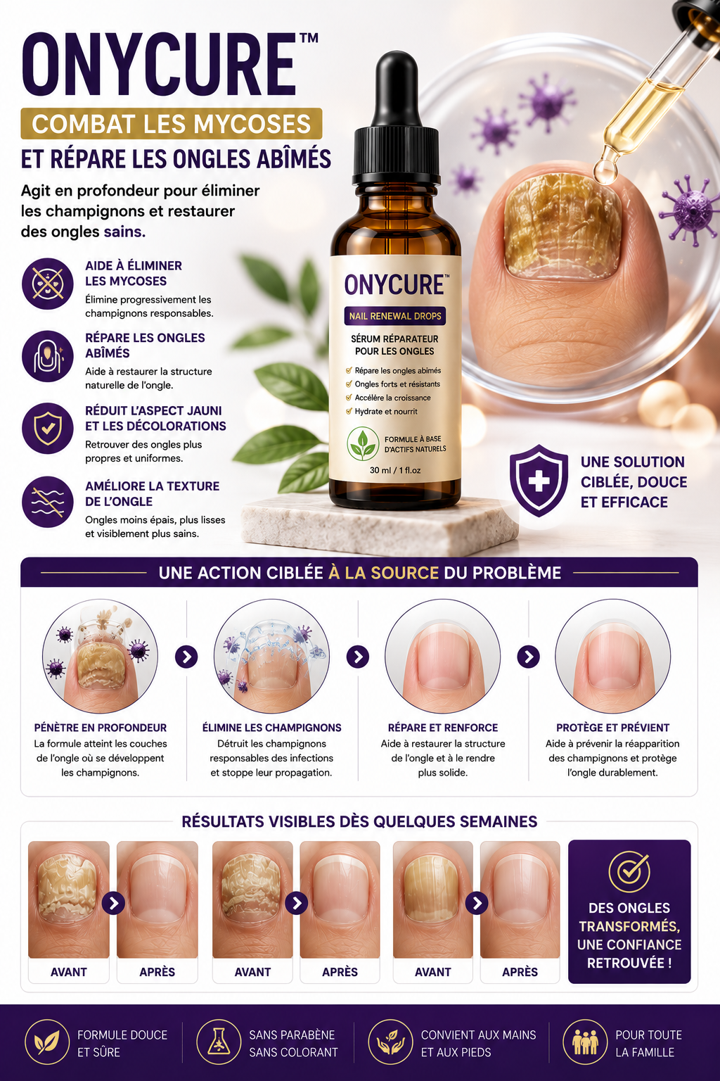 ONYCURE™  Sérum   – Soin Intensif pour Ongles Abîmés