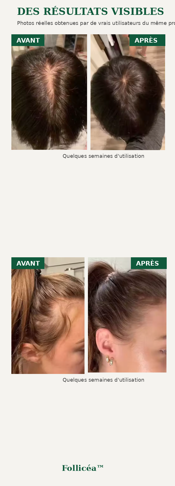 Follicéa™ — Réveillez le potentiel de vos cheveux / Pack de 3 Sérum  de traitement de perte de cheveux